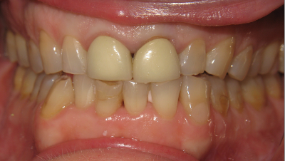 Smile Gallery - Before